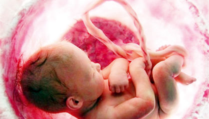 حذف غربالگری؛ افزایش تصاعدی نوزادان متولد شده
با بیماری ژنتیکی

