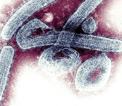 تایید اولین موارد ویروس «ماربورگ» در غنا